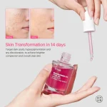 سرم ضد لک نیاسینامید 10% + ترانگزامیک 4% آنوا Anua - Image 2