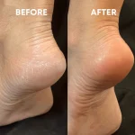 سوهان و رنده پا سوییت کویین Sweet Queen - Image 3